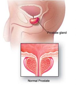 Prostate Health