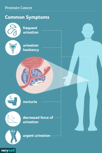 detect prostate cancer